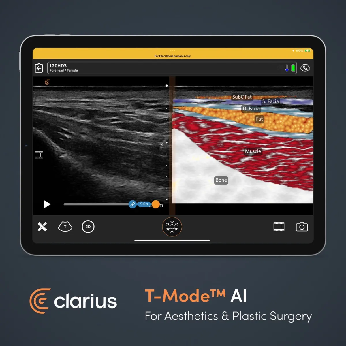 Advanced ultrasound software on tablet at Dr. Pang Skin Clinic