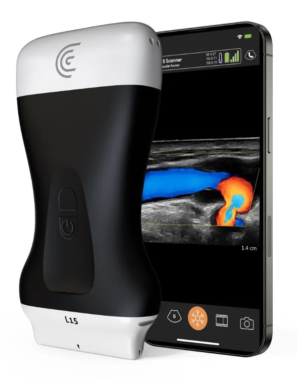Portable ultrasound equipment with real-time scan display on phone at Dr. Pang Skin Clinic