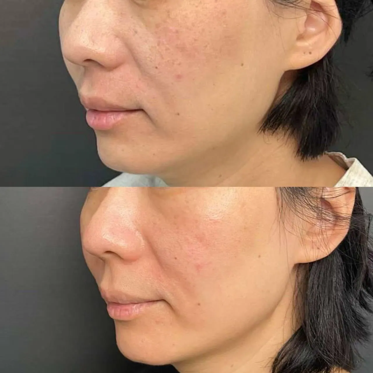 Whitening Cocktail Before & After 2
