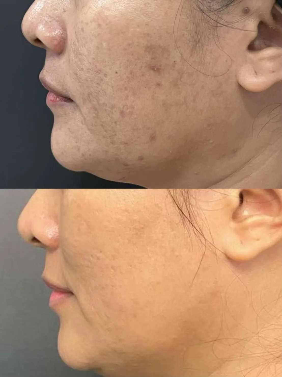 Whitening Cocktail Before & After 9