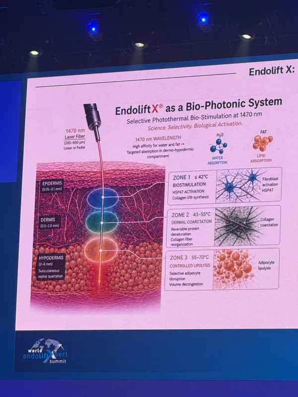 Diagram explaining the EndoliftX bio-photonic system showing 1470nm laser action across epidermis, dermis, and hypodermis skin zones